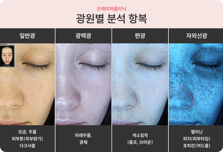 흑자 | 은레이저 클리닉